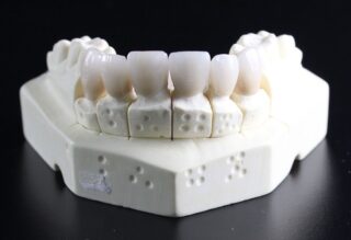 dentures made in an NYC dental laboratory