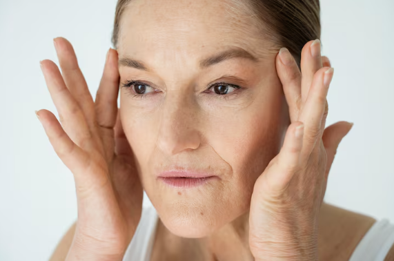 Botox For Crow’s Feet in Queens